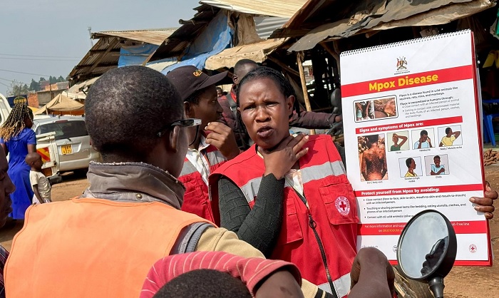 Planet Waspada! Wabah Ebola Melanda Uganda, Bocah Berusia 4 Tahun Meninggal